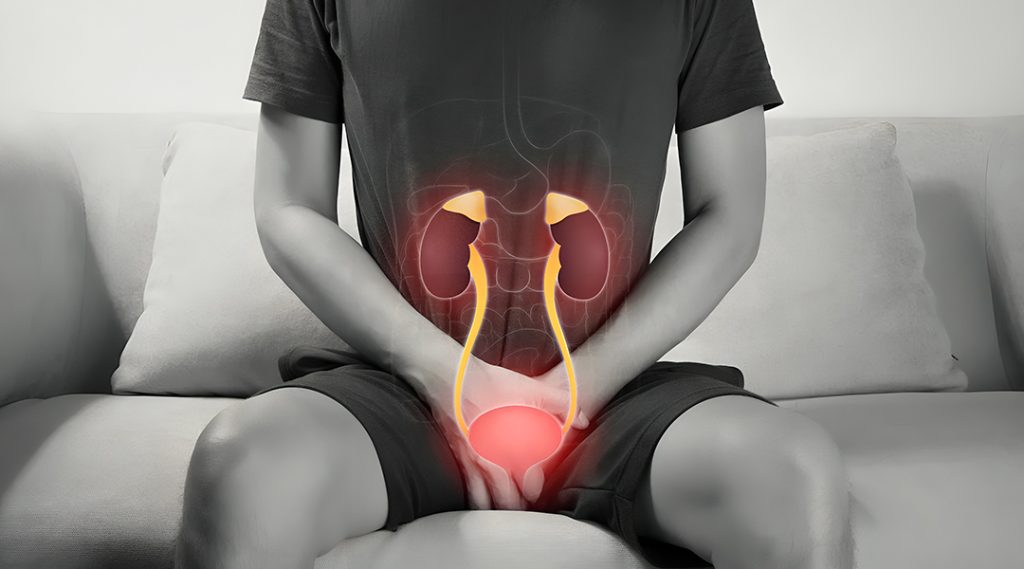 bladder stone