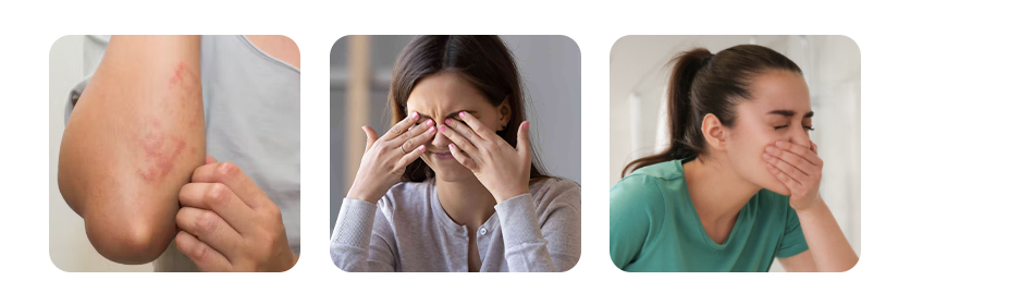 what are the symptoms of dengue fever