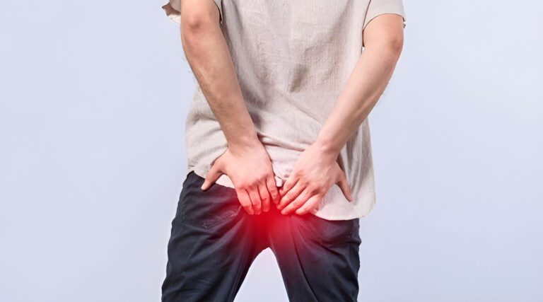 successful management of chronic fissure with grade piles and polyp