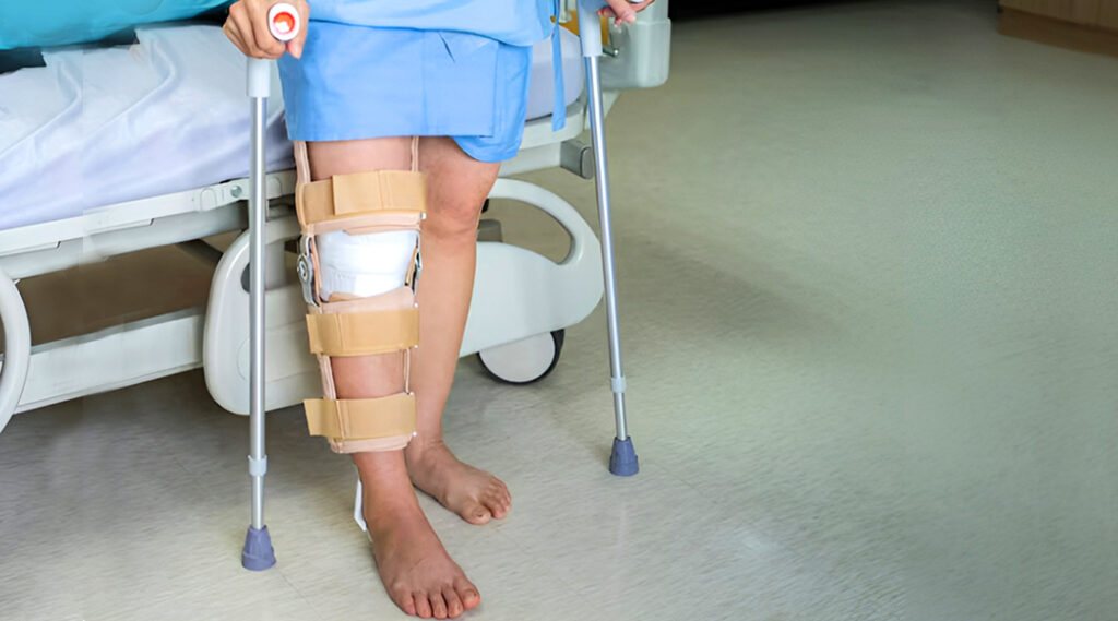 leg fracture recovery case study