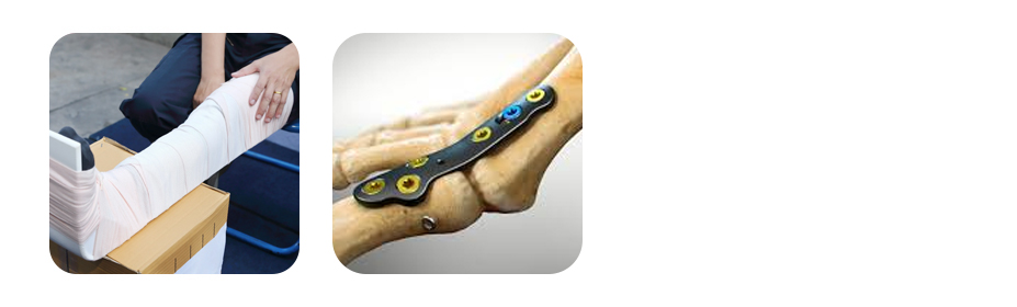 fracture and trauma care