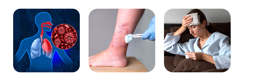 fact 3 smoking weakens the immune system