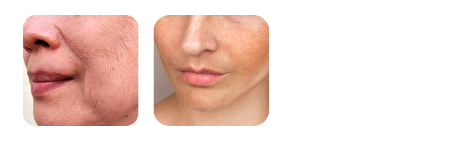 fact 4 smoking accelerates skin aging