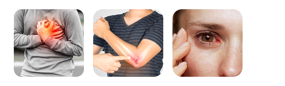 myth 2 smoking only affects the lungs