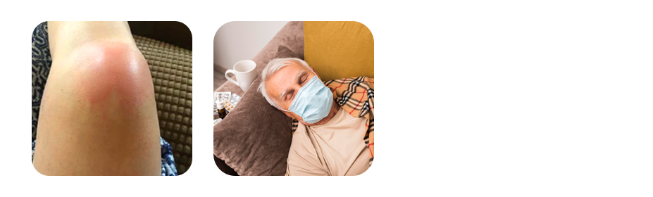 signs of infection to watch for