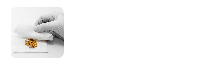 what are gall stones