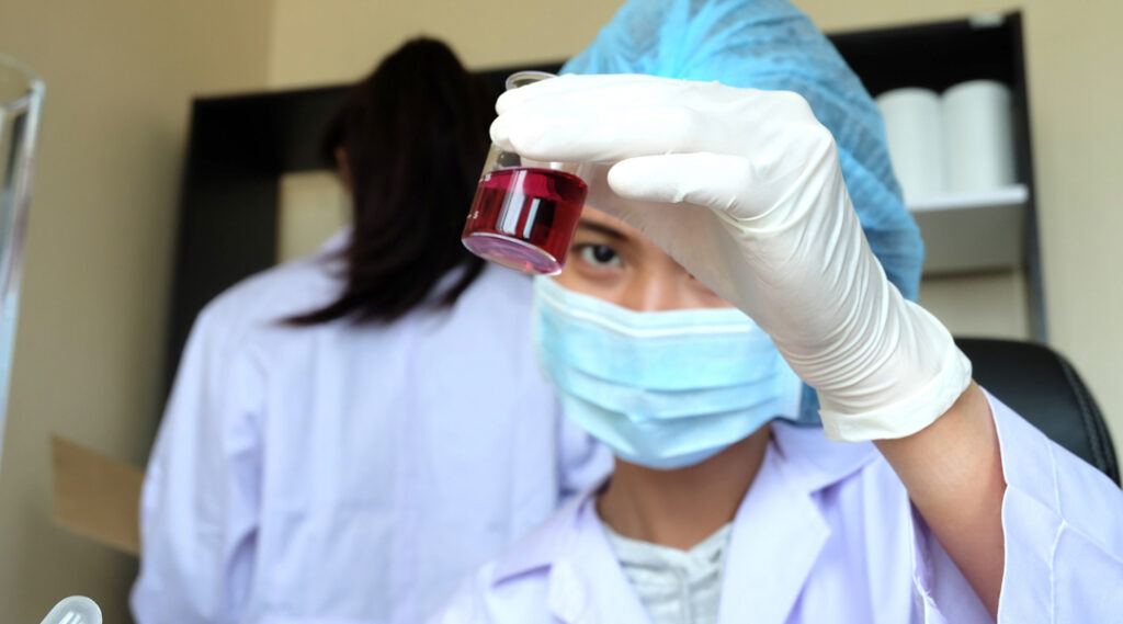 bilirubin normal range levels meaning and health guide