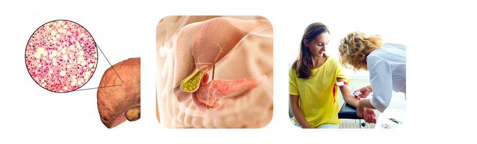 main causes of high bilirubin hyperbilirubinemia