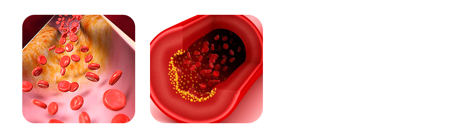 olive oil the gold standard for heart health