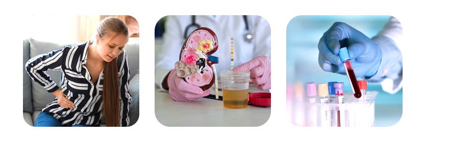 types of bilirubin you should know