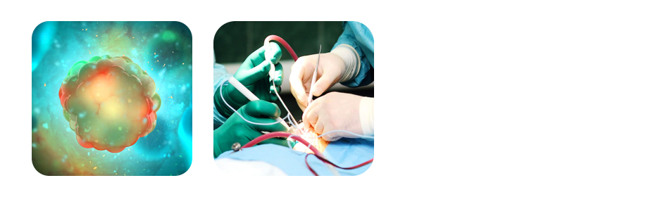 why chemotherapy is important at stage 3