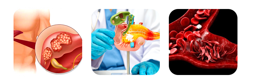 why is bilirubin important