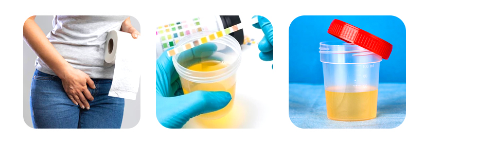 how burning sensation in urine is diagnosed