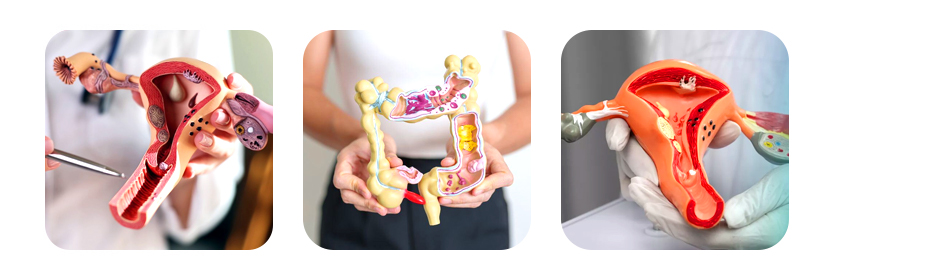 hysteroscopy treatment
