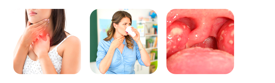 symptoms of throat ulcers