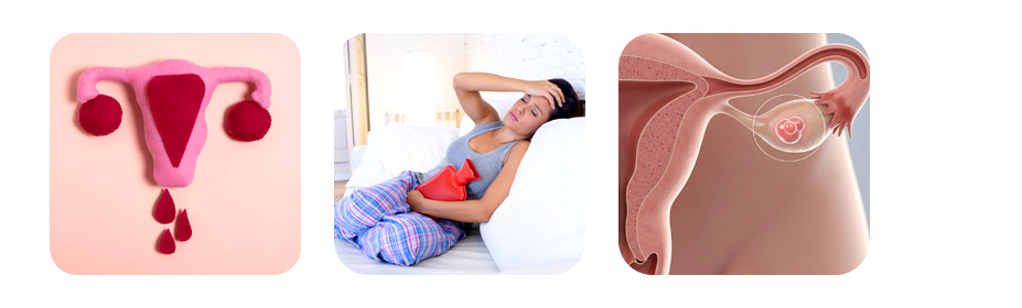 treatment for menstrual disorders